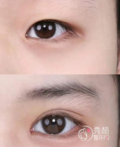 天津全切双眼皮哪家好？市一中心医院、市中西医结合医院、维美、美莱…很出众