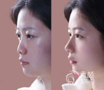 上海整鼻子好的医生是谁