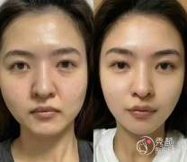 深圳拉皮手术哪家做得好？盘点技术强大、审美不俗的专业整形医院