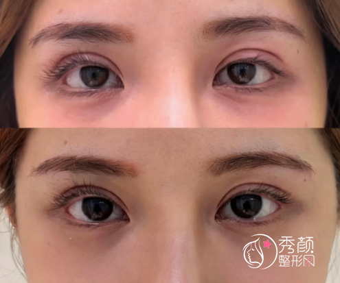 北京眼修复专家排名榜：师丽丽、张冰洁、魏志香、吴焱秋、曹卫华…优势满满