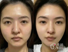 北京拉皮手术医生排名：