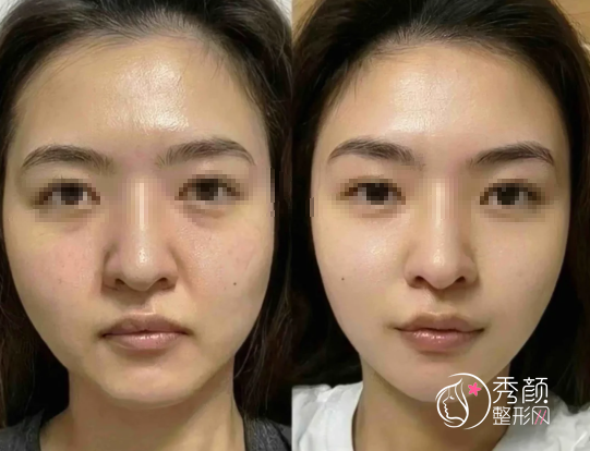 北京拉皮手术医生排名：杨大平、李晓东、黄寅守、柳民熙、杜太超…实力强