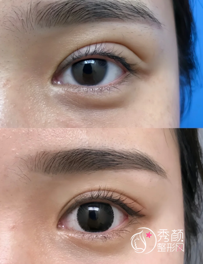 修复双眼皮的十大专家：张冰洁、师丽丽、杜园园、刘建宪…人气旺