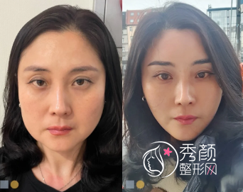 南京拉皮手术哪里好？华美美容、华韩奇致、美贝尔…技术精湛