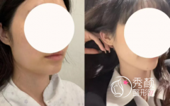 成都磨骨做得好的医生有