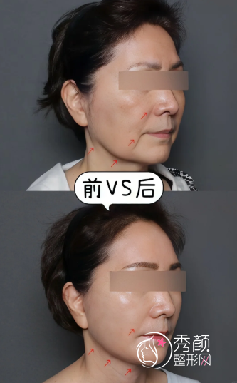 武汉拉皮手术医院排名榜，高口碑、高人气的整形医院名单发布，各有所长