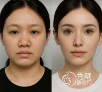 上海超有名鼻子整形专家排名榜：魏皎、丁志、皮庆猛、钱玉鑫…口碑好！