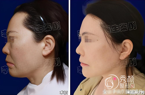 国内十大拉皮名医排名：黄寅守、袁强、穆宝安、魏广运、柳民熙…实力领衔