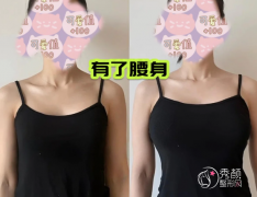重庆自体脂肪丰胸哪个医院做的好？西南医院、铜雀台、新桥医院、松山医院…