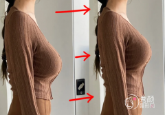 武汉假体隆胸哪个医院做