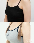 重庆假体隆胸哪个医院做