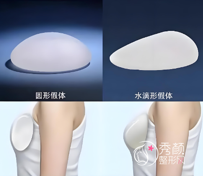 南昌假体隆胸哪家公立医院做的好？南大一附院、南大二附院、省人民医院…技术领先