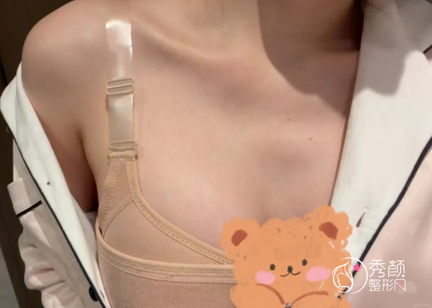 贵阳自体脂肪丰胸哪个医院做的好？贵州医科大学附院、省人民医院、美莱…实力出众