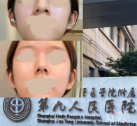 2026上海市第九人民整形医