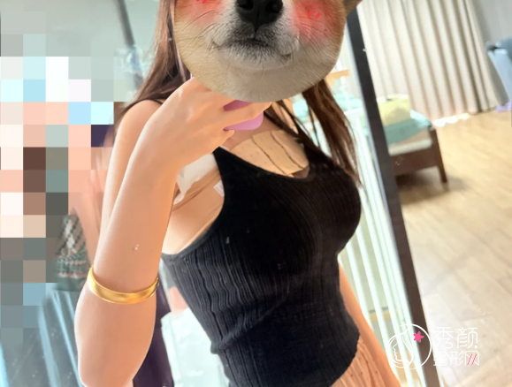 西安假体隆胸哪个医院做的好？省人民医院、西安医学院二附院、壹加壹…实力超强