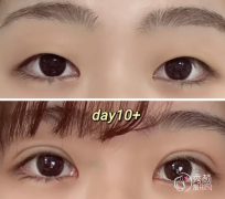 苏薇洁和徐晓斐谁厉害？两位都是行业内的人气眼整形专家