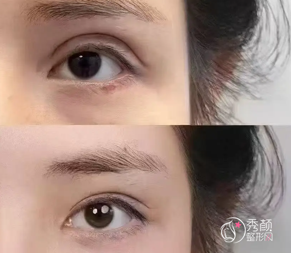 孔宇和田国静谁修复的好？从执业机构、擅长项目、手术量等多方面分析