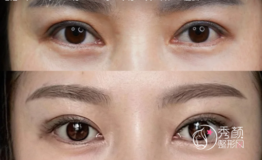 蔡震和游晓波眼修复谁厉害？从个人资料、技术特点来分析对比