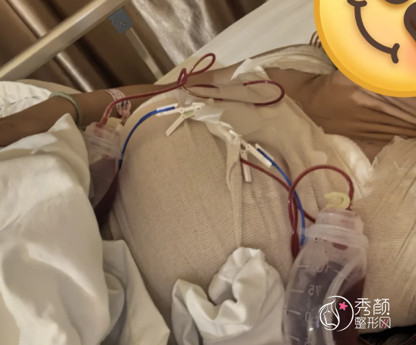 北京隆胸宋宝骥和穆大力谁好？两位均是隆胸领域颇有盛誉的专家