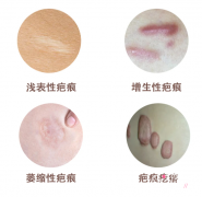 武晓莉和杨东运切