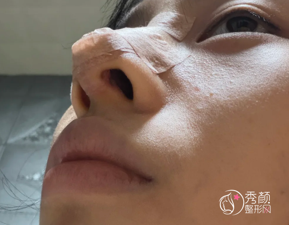 成都鼻修复医生排名：段焘、田孝臣、左程等医生实力上榜