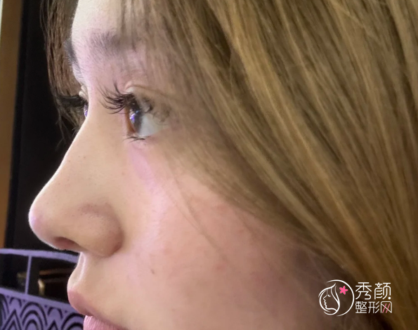 上海鼻修复医生排名：刘凯、冯少清、范荣杰、丁志等医生实力上榜