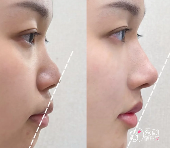 北京鼻修复医生排名：王欢、黄渭清、薛志强、巫文云、郭伶俐等医生实力上榜