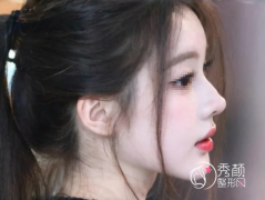 济南鼻修复医生排