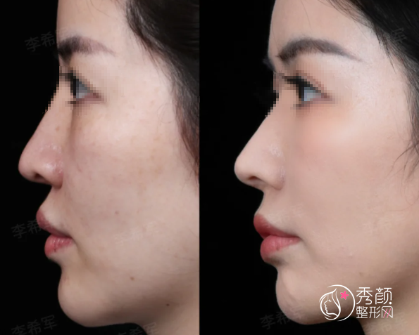 武汉鼻修复医生排名：钟爱梅、徐逸、徐平等医生实力上榜