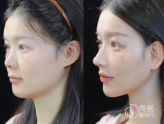 南京鼻修复医生排名：吴杰、宁官森、曹海峰、冯思阳等医生实力上榜