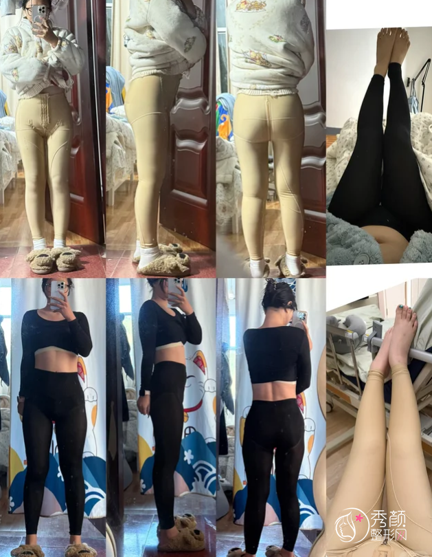 南京吸脂医生排名：黄金龙、崔磊、黄名斗、陈孝闯等实力医生上榜