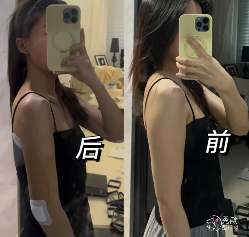 杭州吸脂医生排名：郭松雪、严晟、俞国宝、徐少骏、翟爽等实力医生上榜