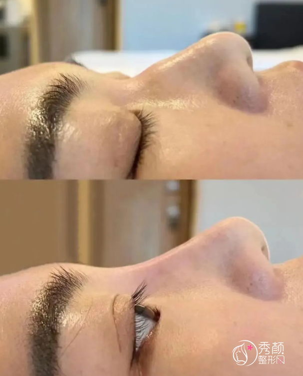 杭州隆鼻医生排名：范希玲、包祺、王洪等实力医生上榜