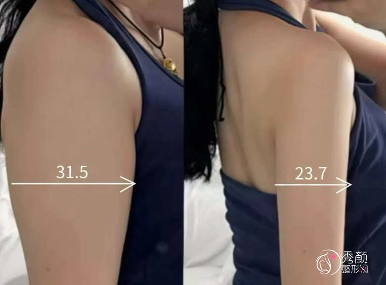 济南吸脂医生排名：李东、肖虎、宋世鹏、逄宝峰等医生实力上榜