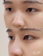 长沙隆鼻医生排名：吴蒙、潘卫峰、蒋松林等医生实力上榜