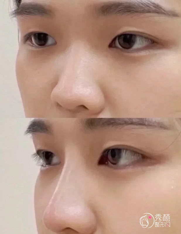 长沙隆鼻医生排名：吴蒙、潘卫峰、蒋松林等医生实力上榜