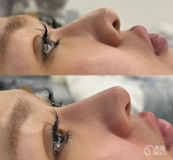 武汉隆鼻医生排名：钟爱梅、徐逸、葛海辉等医生实力上榜