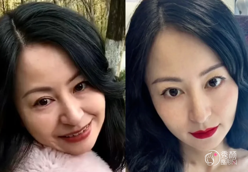 青岛拉皮医生排名：陈振雨、袁家德、孔璐等医生实力上榜