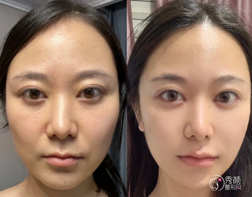 长沙拉皮医生排名：秦晓东、邹俊峰、范鹏举等医生实力上榜