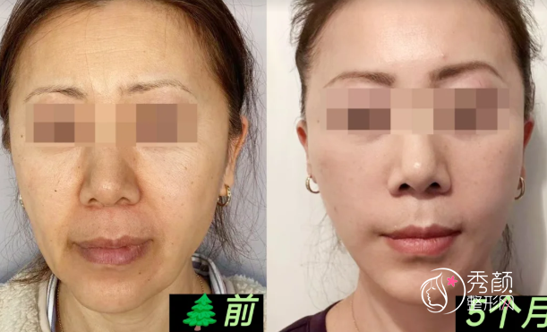 武汉拉皮医生排名：叶子荣、赵贵庆、徐国建等医生实力上榜