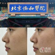 2026北京协和医院整形外科价格表-整形美容外科收费标准一览
