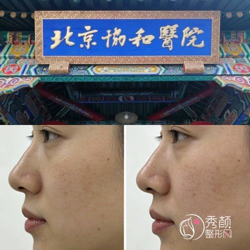 2026北京协和医院整形外科价格表-整形美容外科收费标准一览