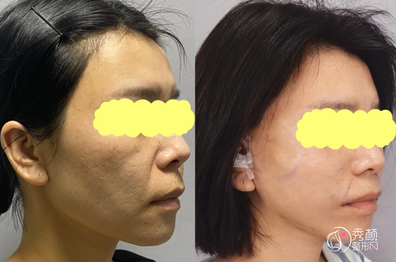 上海拉皮医生排名：倪锋、金勇圭、叶丽萍等医生实力上榜