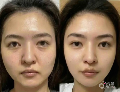 北京拉皮医生排名：谢宏彬、柳民熙、李晓东等医生实力上榜