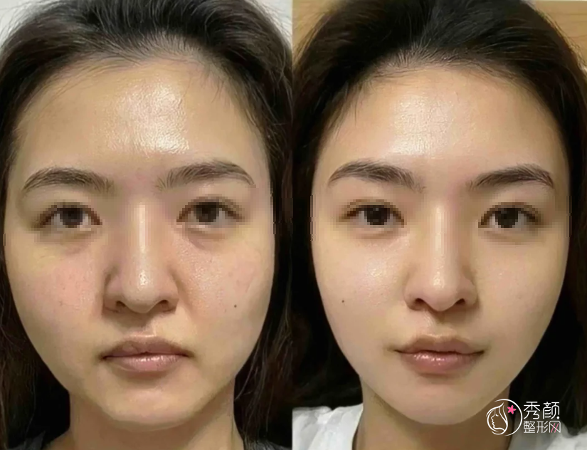 北京拉皮医生排名：谢宏彬、柳民熙、李晓东等医生实力上榜