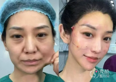 重庆拉皮医生排名：董志勇、章小平、安可忍等医生实力上榜