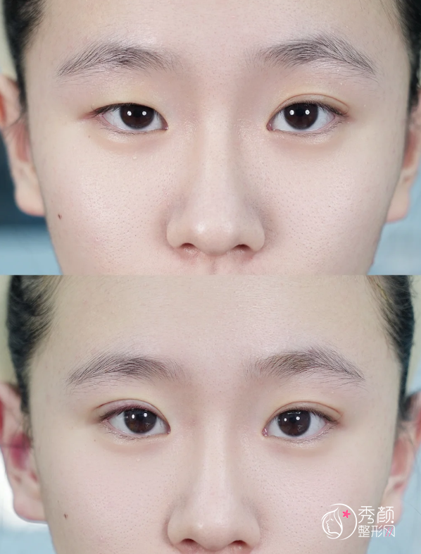 武汉双眼皮医生排名：王海平、顿兆、谭琳等医生实力上榜