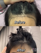 武汉植发医生排名：汪振星、周伟、连力纯等医生实力上榜