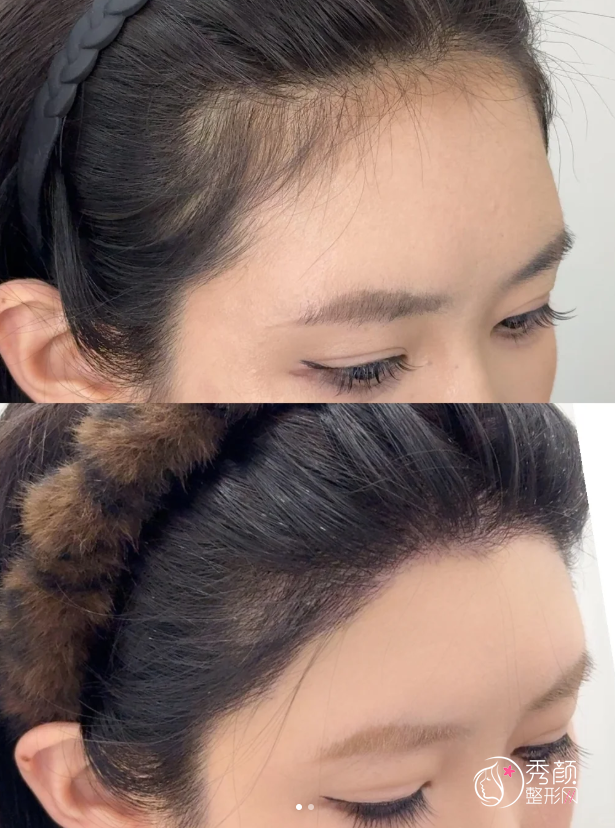 北京植发医生排名：李会民、连燕峰、徐霞等医生实力上榜