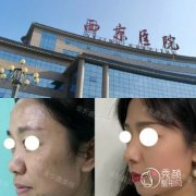 2026西京医院整容价目表-西京医院整形科收费标准一览